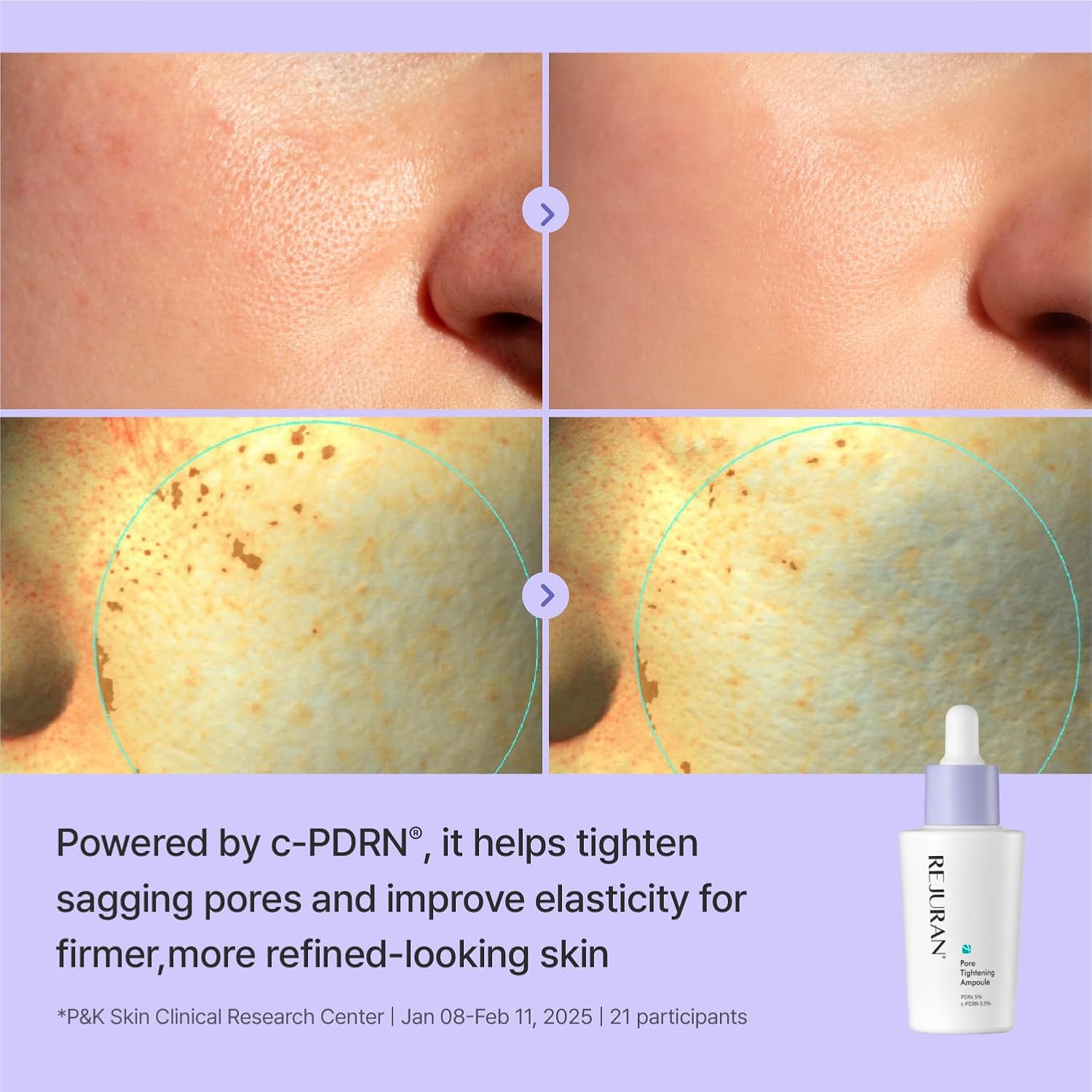 Pore Tightening Ampoule