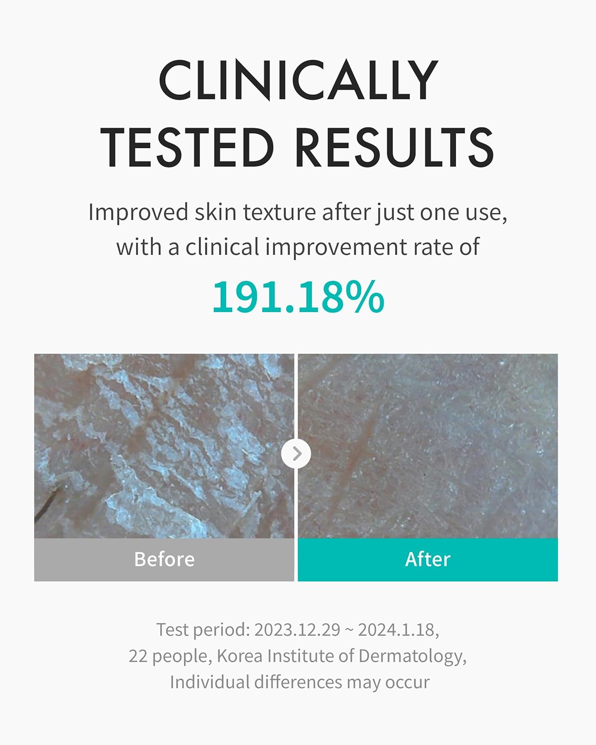 Moisture Treatment Toner
