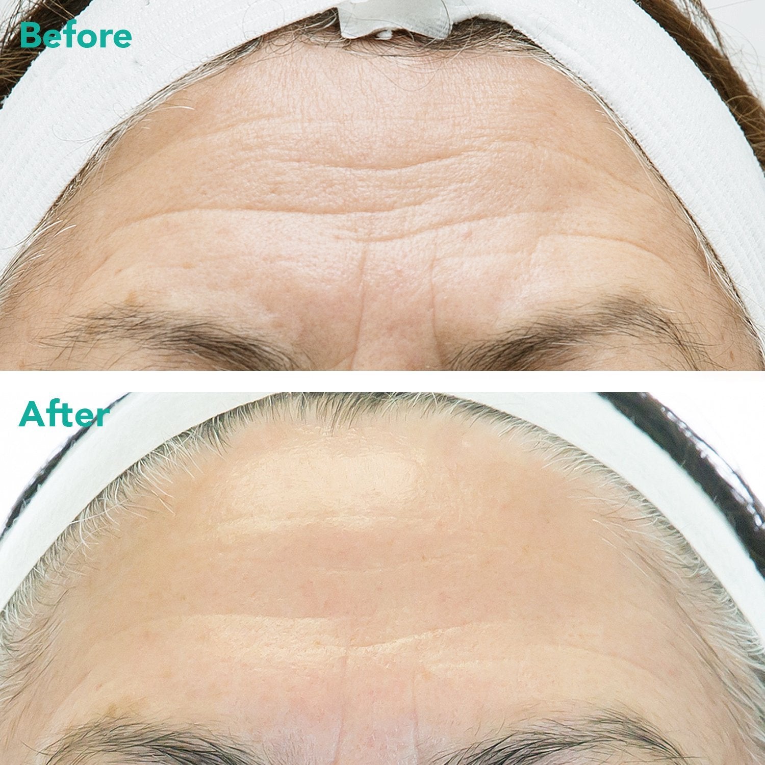 Advanced Anti-Aging Retinol + c-PDRN® Serum