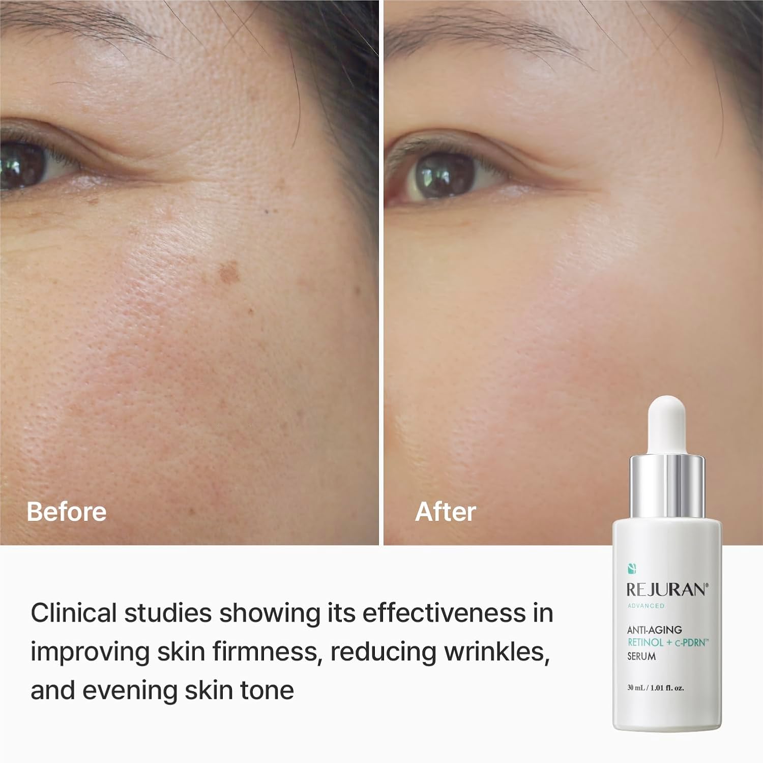 REJURAN® Official | Advanced Anti-Aging Retinol + c-PDRN® Serum