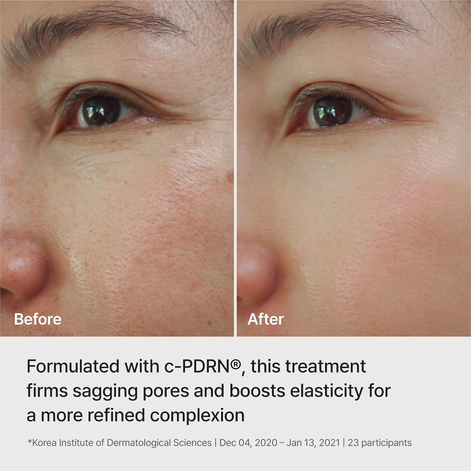 Ampoule Infused Lifting Mask
